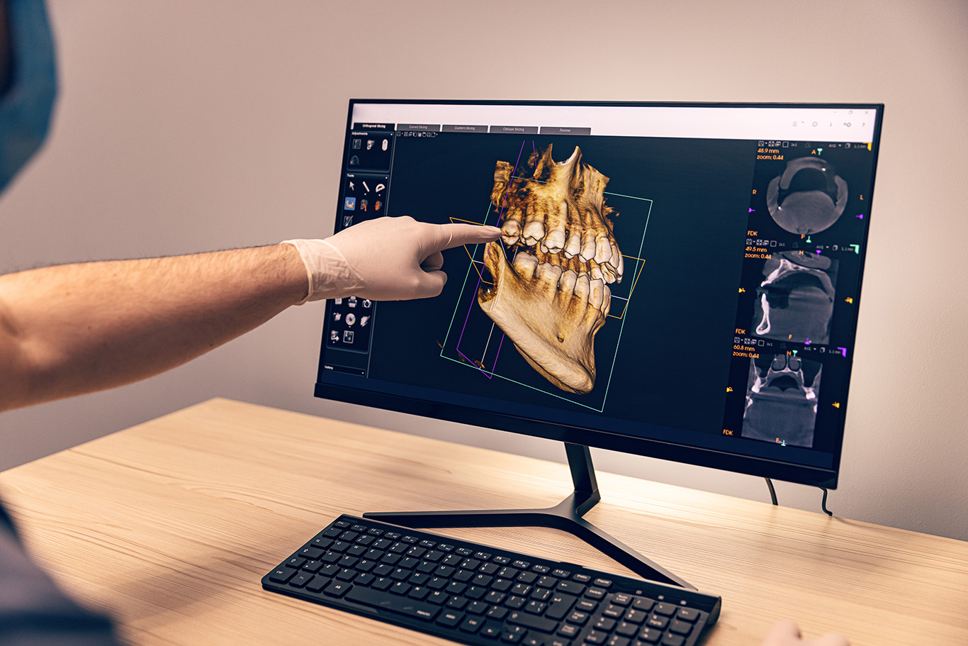 3d dental imaging