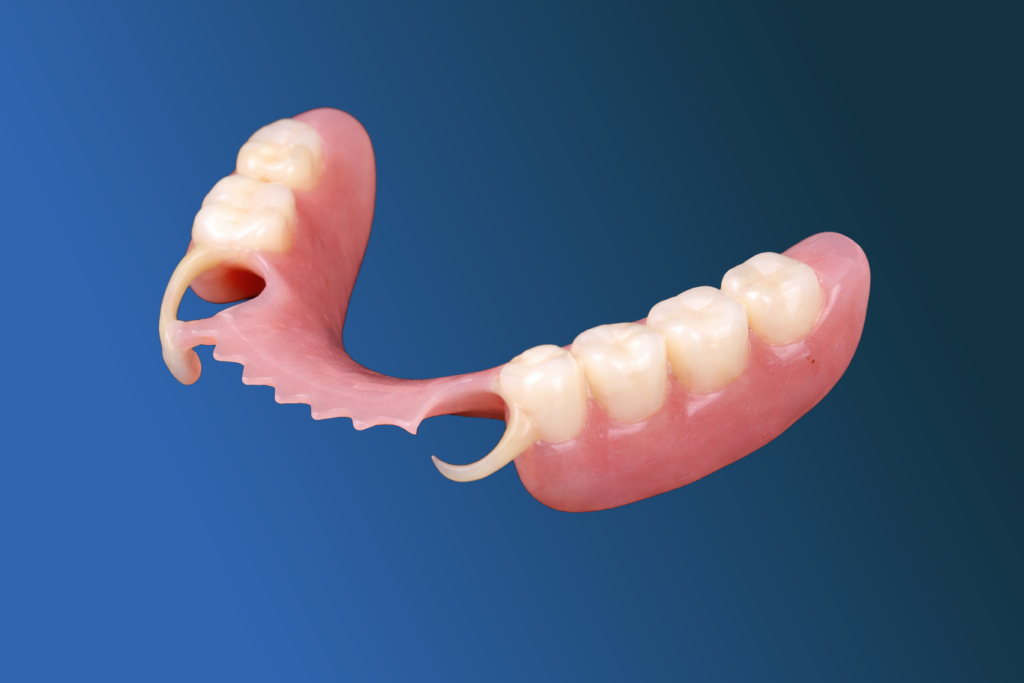 A restorative dentistry solution, this partial denture features artificial teeth and a pink gum-colored base to replace missing lower teeth, displayed against a blue gradient background.