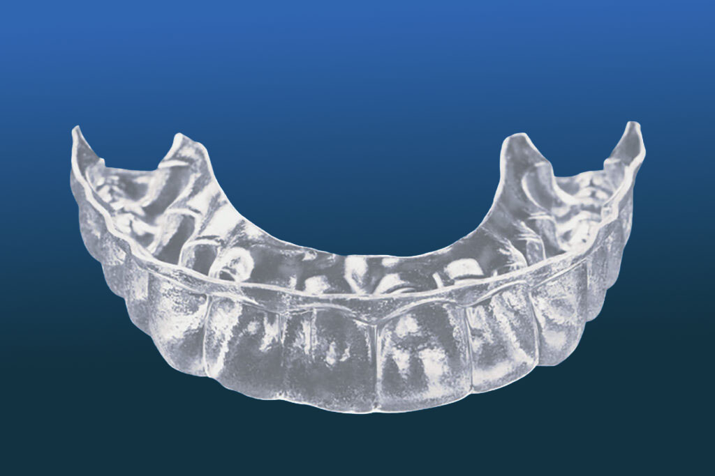 A clear dental aligner or retainer, often used in orthodontics like Invisalign, is displayed against a blue gradient background.